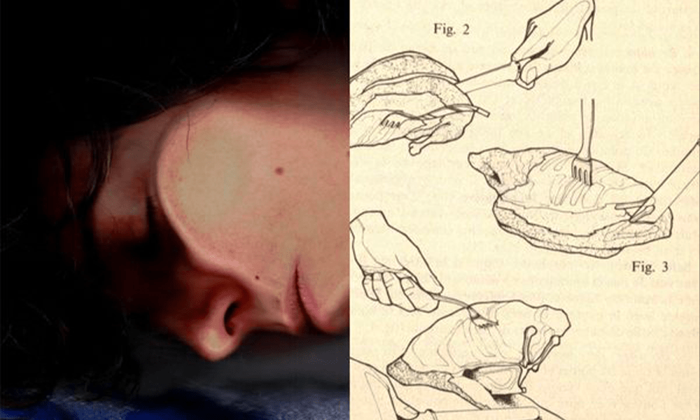 Une photo coupée en deux, l'une avec le visage d'Amélie écrasé sur la vitre du scanner, l'autre moitié un dessin papier de mains en interraction avec des motifs abstraits